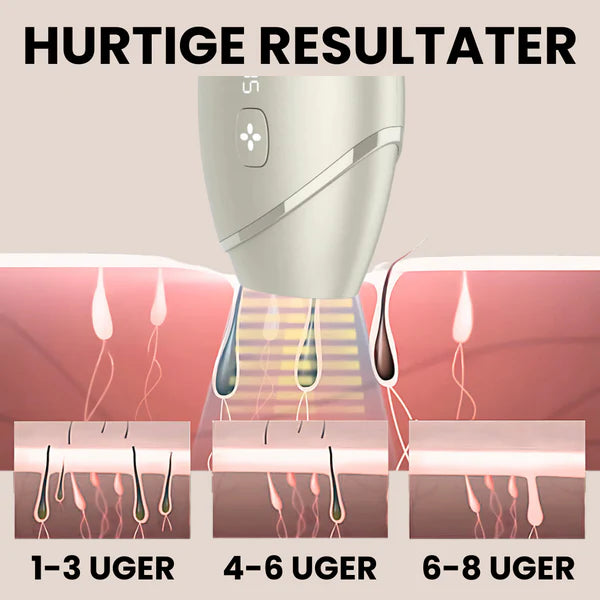 IPL PRO Advanced Hårfjerner - HPLE Teknologi - 17 J/cm² Effekt