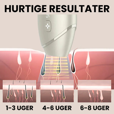 IPL PRO Advanced Hårfjerner - HPLE Teknologi - 17 J/cm² Effekt