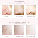 Ultrasonic EMS Ansigts Scrubber